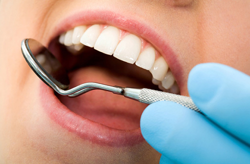 Мифы об отбеливании зубов